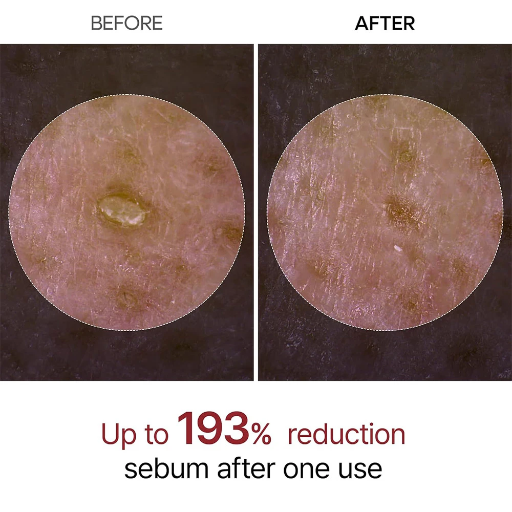 آمپول پیل شات برنج لایه بردار و روشن کننده دکتر ملاکسین4