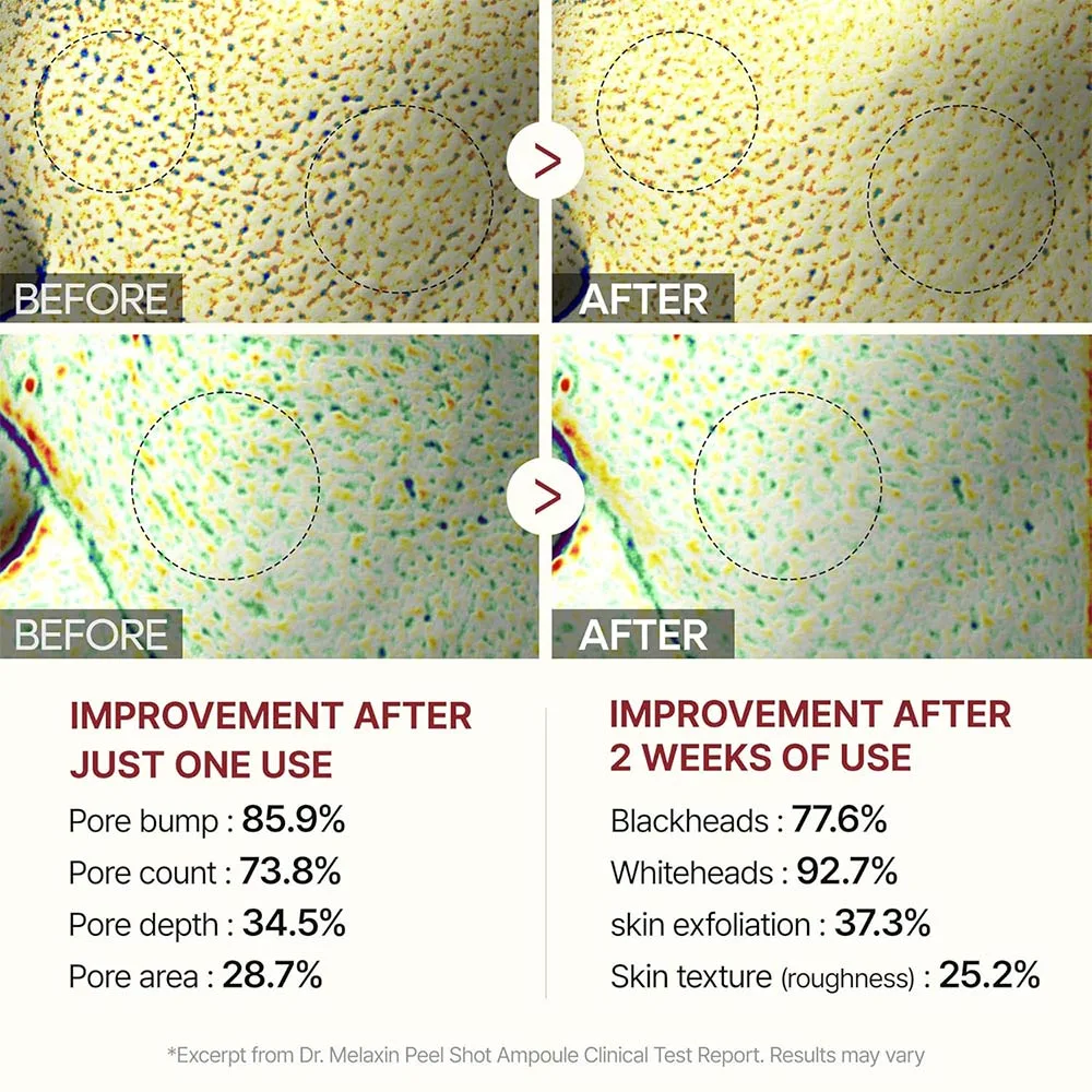 آمپول پیل شات برنج لایه بردار و روشن کننده دکتر ملاکسین